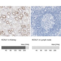 KCNJ1 Antibody, Novus Biologicals:Antibodies:Primary Antibodies